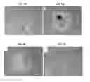 Fig. 09 - Differentiation of stem cells into dopaminergic cells