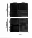 Fig. 02 - BONE MARROW-DERIVED MESENCHYMAL STEM CELLS AS A SOURCE OF NEURAL PROGENITORS
