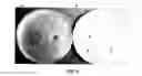 Fig. 06 - Antimicrobial Activity of Bacteriocin-Producing Lactic Acid Bacteria