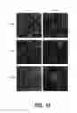 Fig. 19 - Targeting PAX2 for the induction of DEFB1-mediated tumor immunity and cancer therapy