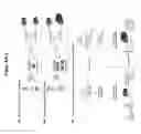 Fig. 06 - COAGULATION FACTOR MODULATION FOR CONTROLLING TRANSPLANT ORGAN SIZE
