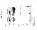 Fig. 07 - COAGULATION FACTOR MODULATION FOR CONTROLLING TRANSPLANT ORGAN SIZE
