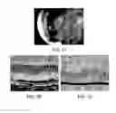 Fig. 02 - Membrane