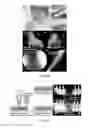 Fig. 22 - INJECTABLE DUAL DELIVERY ALLOGRAPH BONE/POLYMER COMPOSITE FOR TREATMENT OF OPEN FRACTURES