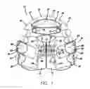 Fig. 02 - Maxillary expansion and advancement orthodontic applicance
