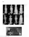 Fig. 01 - METHODS OF SCREENING FOR COMPOUNDS FOR USE AS MODULATORS OF LEFT-RIGHT ASYMMETRY IN SCOLIOTIC SUBJECTS AND FOR MONITORING EFFICACY OF AN ORTHOPAEDIC DEVICE