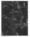 Fig. 02 - Laser scanning cytometry mediated analysis of therapeutic efficacy in tumors