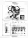Fig. 02 - EMBRYONIC CEREBROSPINAL FLUID (e-CSF), PROTEINS FROM e-CSF, AND RELATED METHODS AND COMPOSITIONS