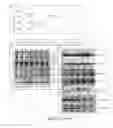 Fig. 17 - EMBRYONIC CEREBROSPINAL FLUID (e-CSF), PROTEINS FROM e-CSF, AND RELATED METHODS AND COMPOSITIONS