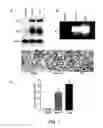 Fig. 02 - MULTICISTRONIC siRNA CONSTRUCTS TO INHIBIT TUMORS