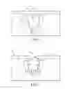 Fig. 02 - Method for forming a through silicon via (TSV)
