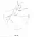 Fig. 06 - Golf club head