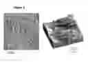 Fig. 03 - Method for producing metal substrates for HTS coating arrangements