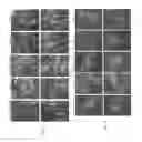 Fig. 03 - Plant-derived elastin binding protein ligands and methods of using the same