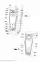 Fig. 04 - Adjustable orthotic device