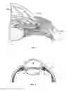 Fig. 02 - Drug delivery devices and methods