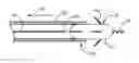 Fig. 01 - Intravascular medical device