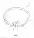 Fig. 02 - Hair removal device