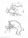 Fig. 02 - APPARATUS INCLUDING MULTIPLE INVAGINATORS FOR RESTORING A GASTROESOPHAGEAL FLAP VALVE AND METHOD