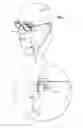 Fig. 02 - ELECTRICAL STIMULATION OF THE EYE