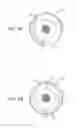Fig. 03 - ELECTRICAL STIMULATION OF THE EYE