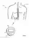 Fig. 02 - Closed-loop therapy adjustment