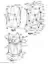 Fig. 07 - Method for direct implantation of a heart valve prosthesis