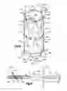 Fig. 09 - Method for direct implantation of a heart valve prosthesis