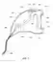 Fig. 07 - System and method for providing a single use imaging device for medical applications