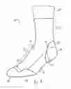 Fig. 02 - Selectively feltable garment