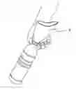 Fig. 01 - URINE BOTTLE ADAPTER