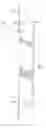 Fig. 06 - Curved profile sponge mop system