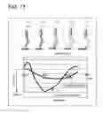 Fig. 15 - Sole Structure for a Shoe