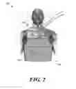 Fig. 03 - Device for stimulating adaptive thermogenesis in brown adipose tissue
