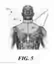 Fig. 06 - Device for stimulating adaptive thermogenesis in brown adipose tissue