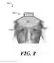 Fig. 09 - Device for stimulating adaptive thermogenesis in brown adipose tissue