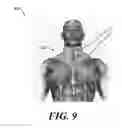 Fig. 10 - Device for stimulating adaptive thermogenesis in brown adipose tissue