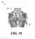 Fig. 11 - Device for stimulating adaptive thermogenesis in brown adipose tissue