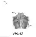 Fig. 13 - Device for stimulating adaptive thermogenesis in brown adipose tissue