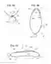 Fig. 17 - Magnetic securing device assembly and method for securing a garment while nursing