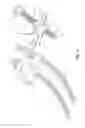 Fig. 03 - Portable truing device for spoked wheels and method of use