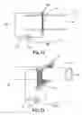 Fig. 11 - AEROSOL FORMING DEVICE FOR USE IN INHALATION THERAPY
