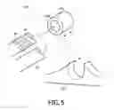 Fig. 06 - RESPIRATORY INTERFACE DEVICE INCLUDING A MECHANISM FOR MANAGING NOSE BRIDGE PRESSURE
