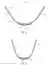 Fig. 04 - SECUREMENT SYSTEM FOR AN ENDOCTRACHEAL TUBE