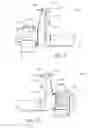 Fig. 07 - SECUREMENT SYSTEM FOR AN ENDOCTRACHEAL TUBE