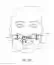 Fig. 19 - SECUREMENT SYSTEM FOR AN ENDOCTRACHEAL TUBE