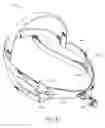 Fig. 20 - SECUREMENT SYSTEM FOR AN ENDOCTRACHEAL TUBE