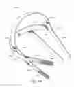 Fig. 28 - SECUREMENT SYSTEM FOR AN ENDOCTRACHEAL TUBE