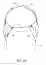 Fig. 32 - SECUREMENT SYSTEM FOR AN ENDOCTRACHEAL TUBE
