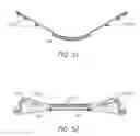 Fig. 35 - SECUREMENT SYSTEM FOR AN ENDOCTRACHEAL TUBE